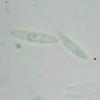 Chlorociboria aeruginosa spores eric