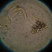 Spherocytes et spores de russules